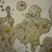 H2-105418 důlková koroze (2,5x).jpg H2-105418 důlková koroze (2,5x).jpg